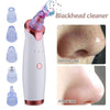 BlackVac™ Blackhead & Pore Vacuum