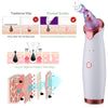 BlackVac™ Blackhead & Pore Vacuum