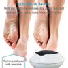 USB CHARGING MULTIFUNCTIONAL ELECTRIC FOOT GRINDER MACHINE EXFOLIATING DEAD SKIN CALLUS REMOVER FOOT CARE PEDICURE DEVICE